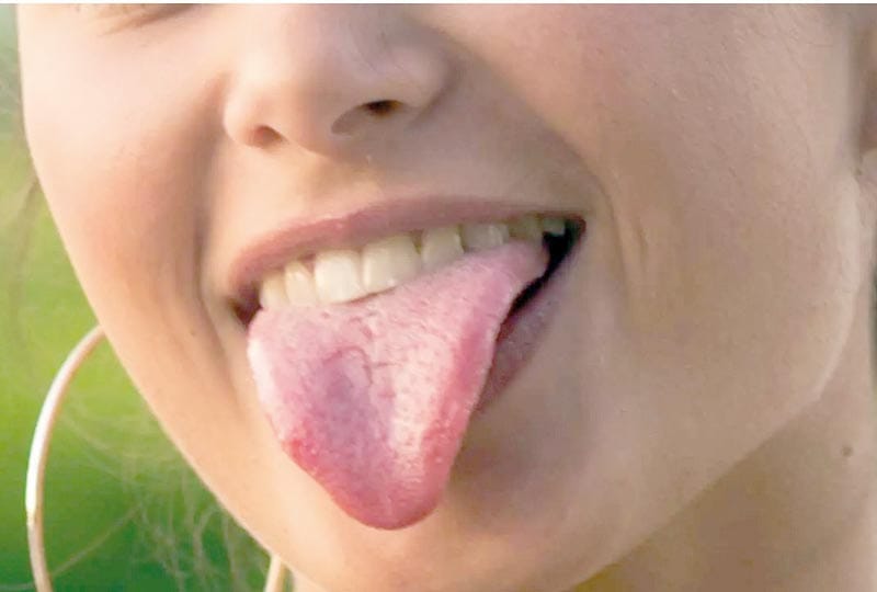 FUMAR, MALA HIGIENE Y SEXO SIN PROTECCIÓN PUEDEN PROVOCAR CÁNCER EN LA BOCA, ALERTA IMSS