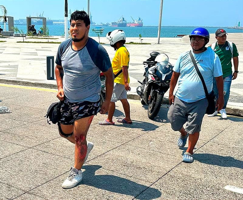 ¡RASPADO EN EL BULEVAR!