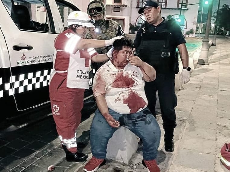 ¡LE BAJAN “EL CUETE” A COCOTAZOS!