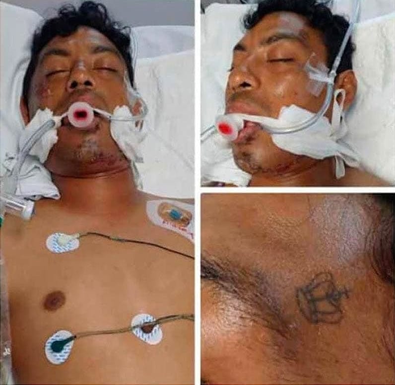 ¡ATROPELLADO EN LA SALIDA NORTE! - *BUSCAN A SUS FAMILIARES