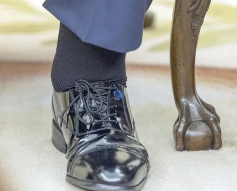 ¡TRUMP SALE CON INSUFICIENCIA VENOSA CRÓNICA!