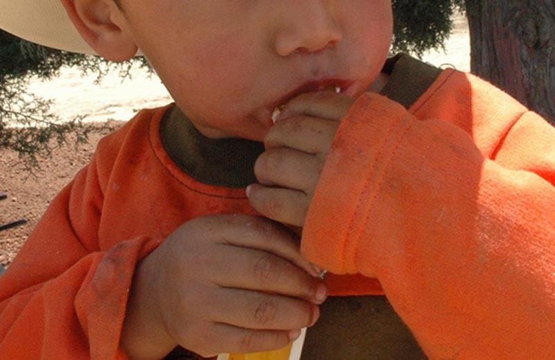 ¡HAY BROTE DE COXSACKIE! - *50 casos en menores en Tlaquilpa