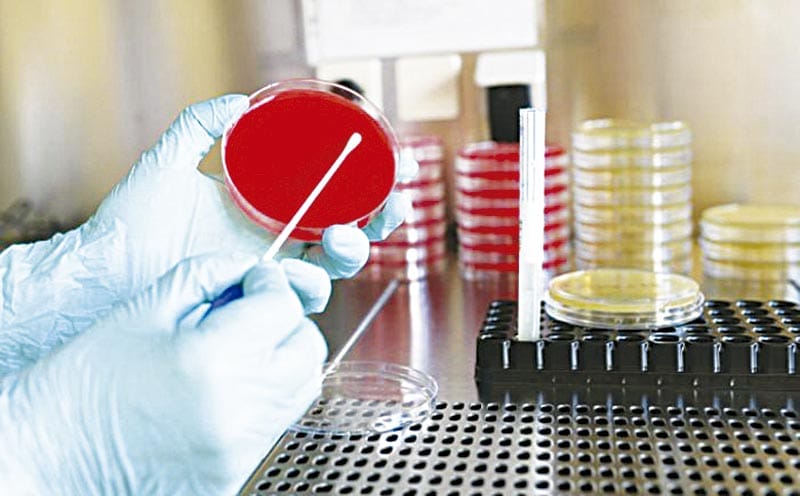 ¡VERACRUZ REPORTA 37 CASOS DE PARÁLISIS FLÁCIDA AGUDA!