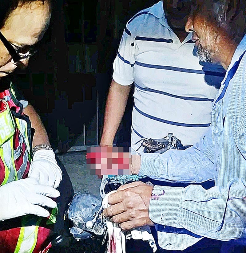 ¡ABUELITO CASI PIERDE EL DEDO EN RIÑA DE ‘NINJAS’!