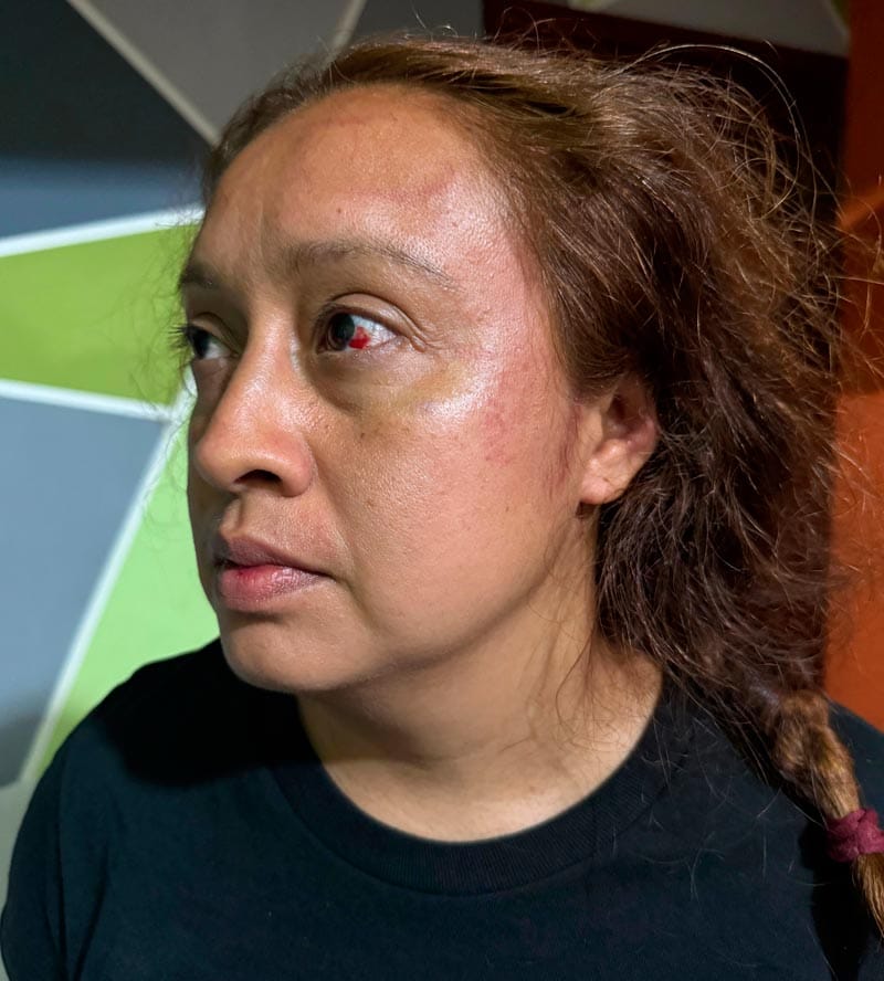 ¡POLICÍAS DE SOLEDAD DETIENEN Y DAN GOLPIZA A MATRIMONIO! - POR IR “EBRIO” DETUVIERON AL MARIDO Y LA ESPOSA POR EVITAR QUE LES ROBARAN LA MOTO