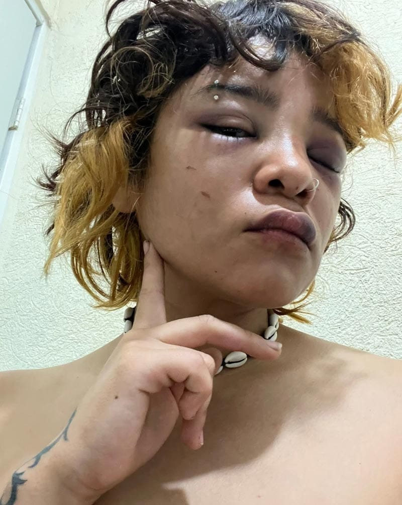 ¡JOVENCITA DENUNCIÓ QUE LE DIERON UNA GOLPIZA DENTRO DEL “MUTE BAR”!