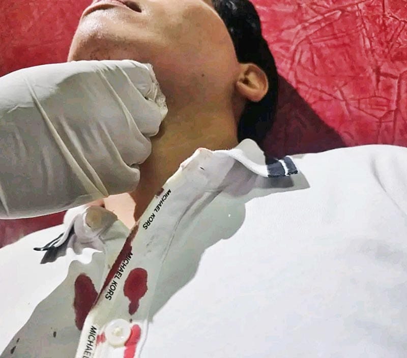 ¡BORRACHO ACUCHILLÓ EN EL CUELLO A JOVEN TRABAJADOR!