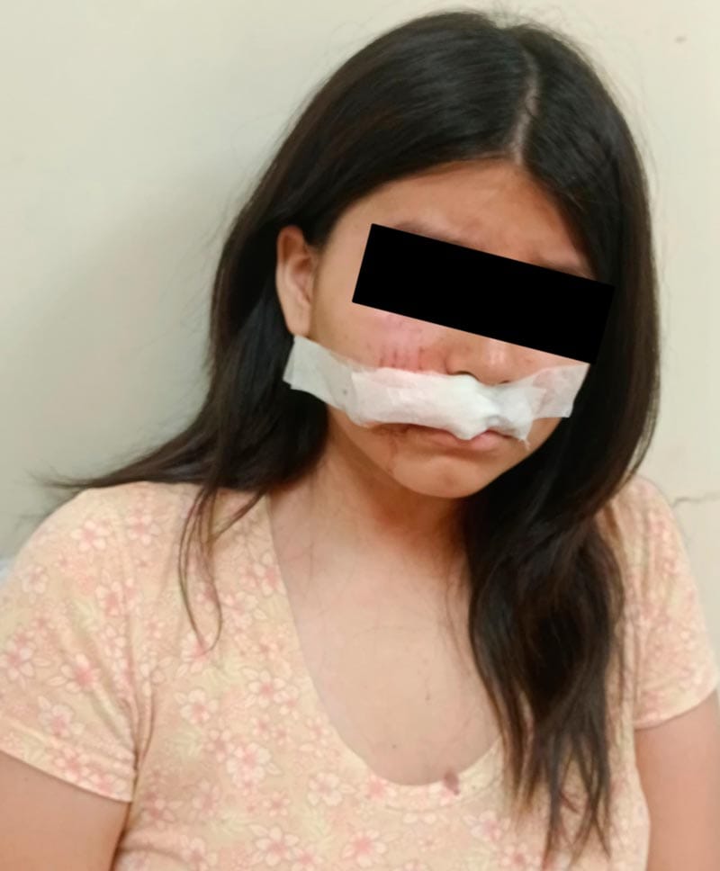 ¡DENUNCIAN A INTEGRANTES DE ‘FINANCIERA’ POR AGREDIR CON UNA PIEDRA A MENOR DE EDAD!