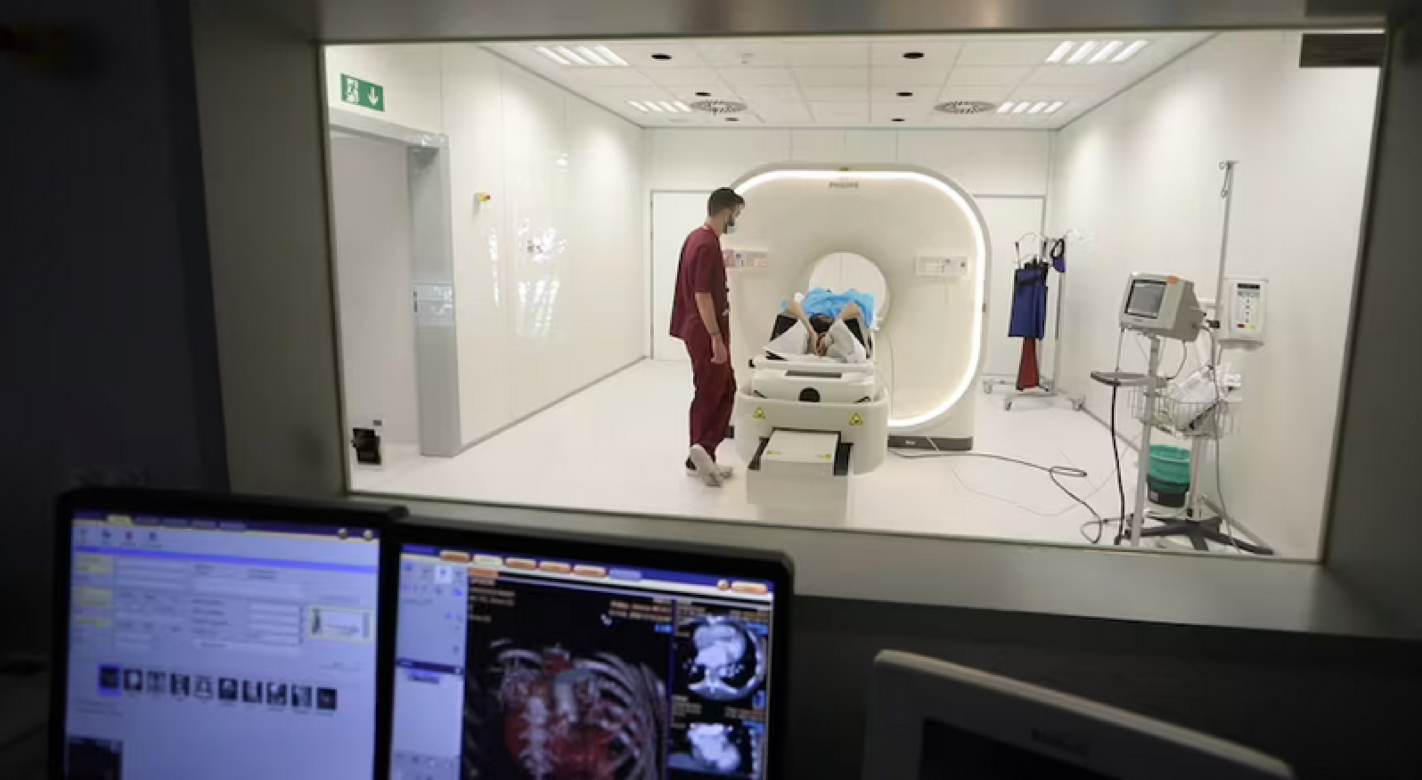 TIPS PARA MEJORAR TU CALIDAD DE VIDA | ATEROESCLEROSIS - La palabra ateroesclerosis proviene de los vocablos griegos athero (pasta) y skleros (duro), y consiste en el depósito de colesterol en las paredes…