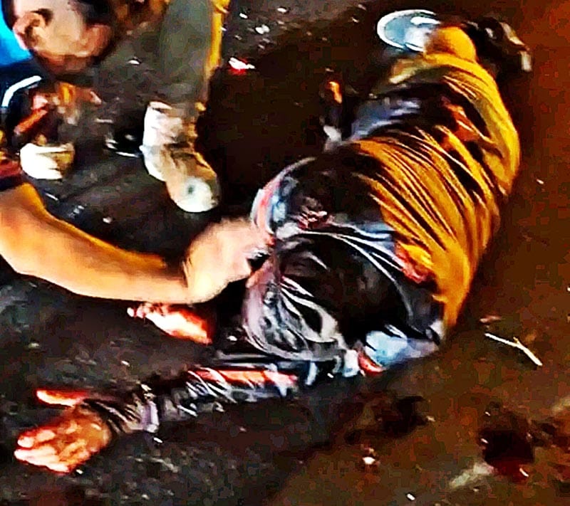 MOTOCICLISTA CHOCÓ CONTRA TRÁILER Y ACABÓ FRACTURADO DE LAS PIERNAS!