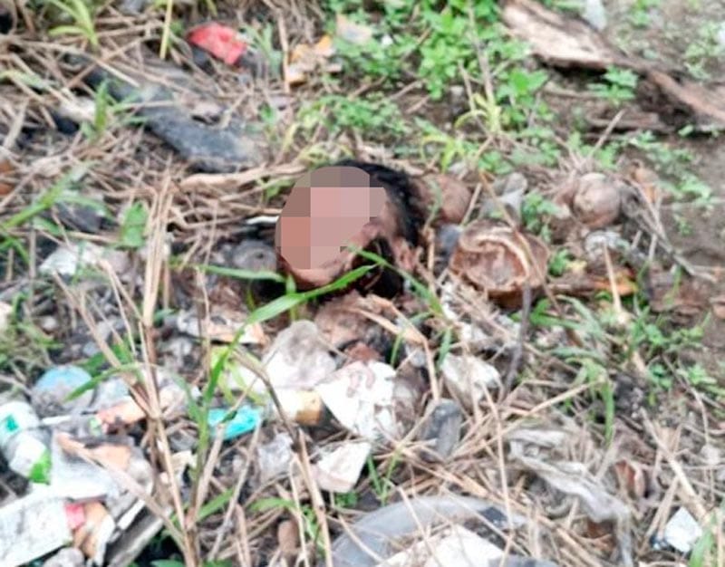 ¡DEJAN CABEZA HUMANA BAJO EL PUENTE CARACOL!