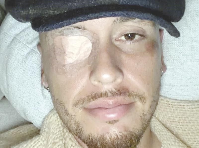 ¡PRESENTA OCAMPOS PARÁLISIS FACIAL!; ADIÓS PRETEMPORADA!