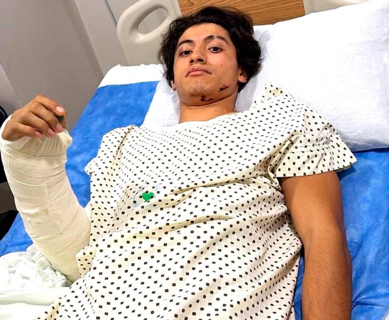 ¡ARROLLAN A MOTOCICLISTAS Y LOS ABANDONAN A SU SUERTE!