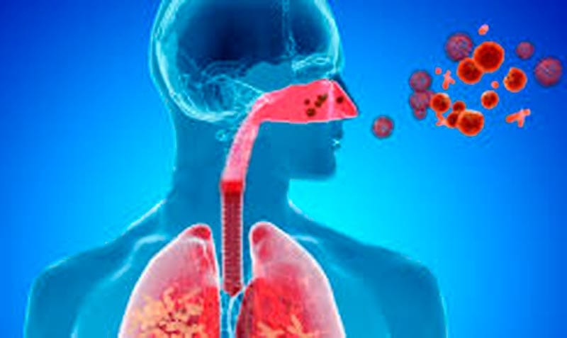 TIPS PARA MEJORAR LA CALIDAD DE VIDA | INFECCIONES DE VIAS RESPIRATORIAS - Las infecciones de las vías respiratorias pueden definirse como condiciones autolimitadas con irritación e inflación, que involucran la nariz, senos paranasales, laringe...