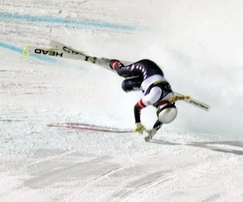 ¡OPERAN A LINDSEY VONN TRAS FRACTURA DE PIERNA IZQUIERDA!