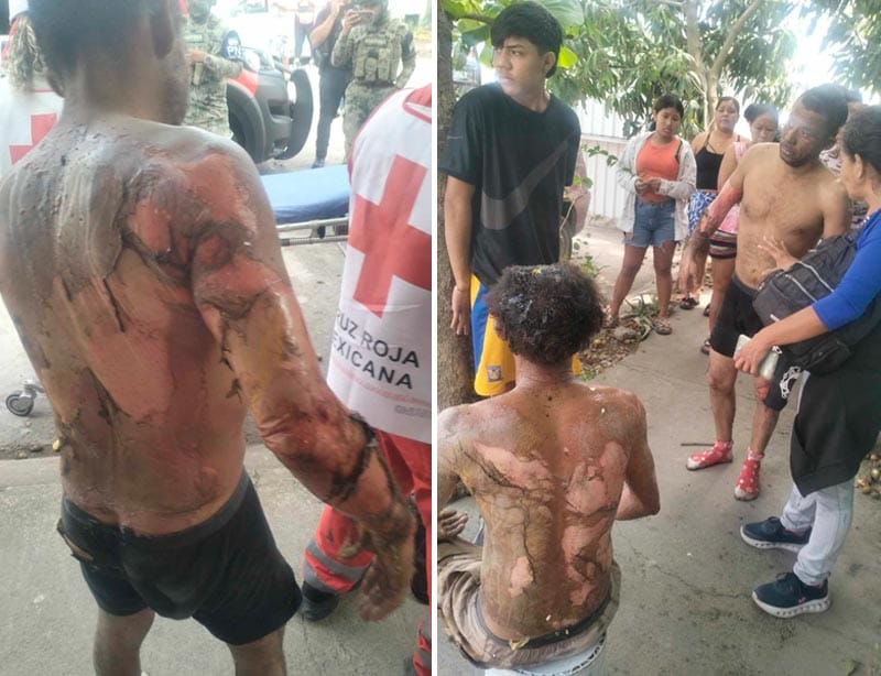 ¡DOS HOMBRES QUEMADOS EN INCENDIO DE UN PATIO!