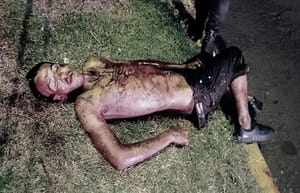 ¡LO ENCUENTRAN ENSANGRENTADO Y CON UN MACHETÓN! - |ÉL, SOLO TENÍA GOLPES