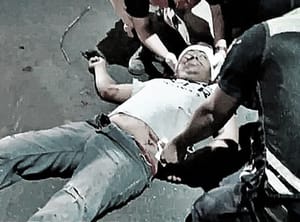 ¡MOTOCICLISTA SE DEBATE ENTRE LA VIDA Y LA MUERTE! - |IBA SIN CASCO Y CHOCO DE FRENTE CONTRA UNA CAMIONETA