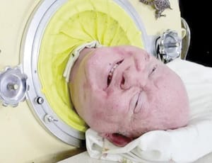 ¡MUERE HOMBRE DEL ‘PULMÓN DE HIERRO’!