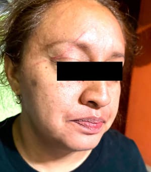 ¡DENUNCIAN A LA POLICÍA DE SOLEDAD DE DOBLADO!