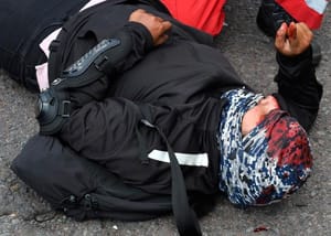 ¡MUJER MOTOCICLISTA CHOCÓ TRES VECES EN LA MISMA CALLE!