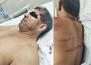 ¡SALVAJE GOLPIZA A CIRINO RAMÓN EX COMANDANTE DE LA FUERZA CIVIL!