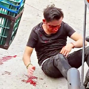 ¡CON TREMENDA GOLPIZA DESFIGURAN A “EL PONY”!