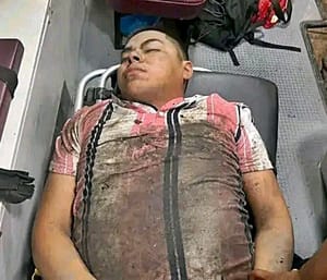 ¡MUCHACHO CAYÓ CON TODO Y MOTO A CANAL DE AGUAS NEGRAS!