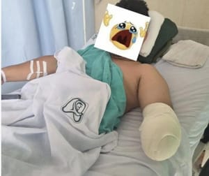 ¡JOVEN PERDIÓ SU BRAZO EN LA MÁQUINA DE TORTILLAS!