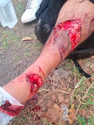¡MOTOCICLISTA SE REBANA LA PIERNA EN DERRAPÓN!