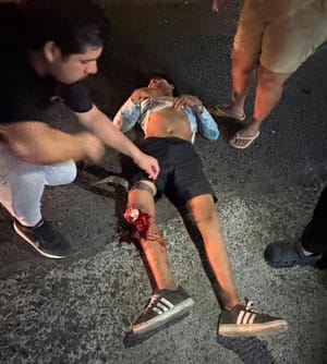 ¡DOS JOVENES MENORES GRAVES IMPACTADOS POR AUTO JAPONÉS!