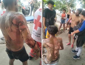 ¡DOS HOMBRES QUEMADOS EN INCENDIO DE UN PATIO!