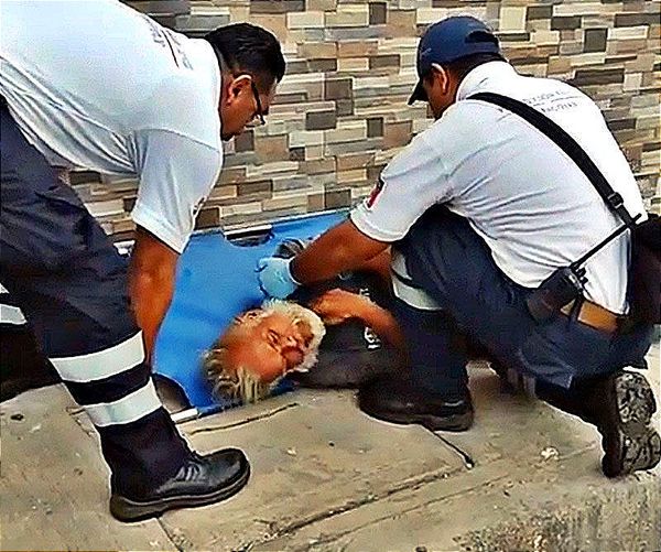 ¡ABUELITO PIERDE EL EQUILIBRIO Y SE FRACTURA EL CRÁNEO!