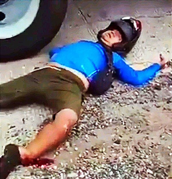 ¡TRAILERO ARROLLA MOTOCICLISTA Y LO DEJA FRACTURADO DE LAS PIERNAS!