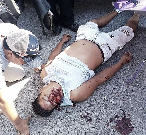 ¡MOTORIZADO SE ESTRELLA CON AUTO EN BOCA DEL RÍO!