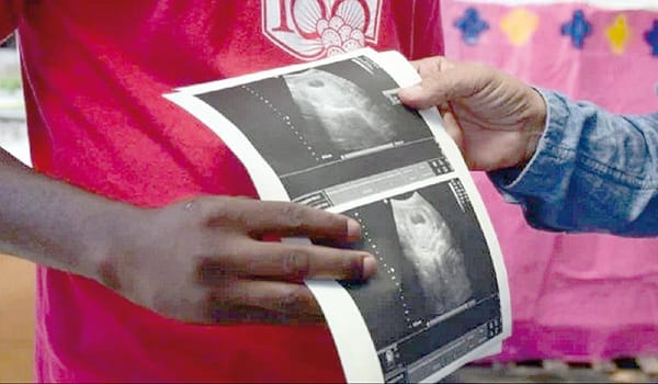 UNAM ADVIERTE AUMENTO DE INFERTILIDAD EN 15% DE LAS PAREJAS