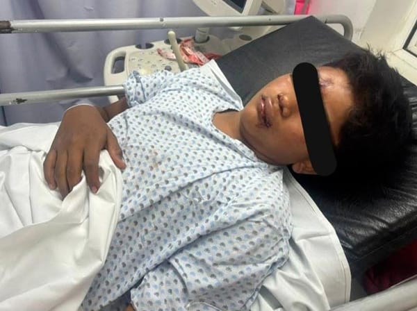 ¡INGRESAN A LA TORRE PEDIÁTRICA NIÑO GOLPEADO POR BORRACHOS!