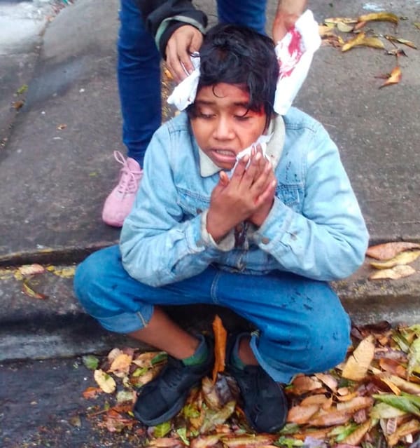 ¡NIÑO DE 12 AÑOS HERIDO EN UNA RIÑA!