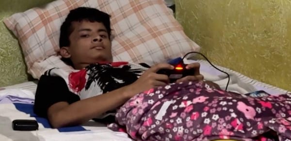 ¡BRANDON GAEL! - *Le cortarán aún más su pierna