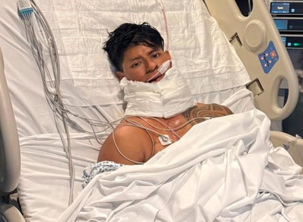 ¡VERACRUZANO QUE PERDIÓ MANDÍBULA POR EL CÁNCER, VIVE NUEVA LUCHA!