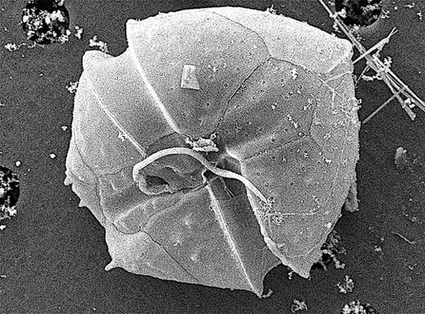 ¡CONTAMINACIÓN DEL AGUA PROVOCA LAS ALGAS TÓXICAS Y LOS PECES QUE PUEDEN ENFERMAR A LAS PERSONAS!