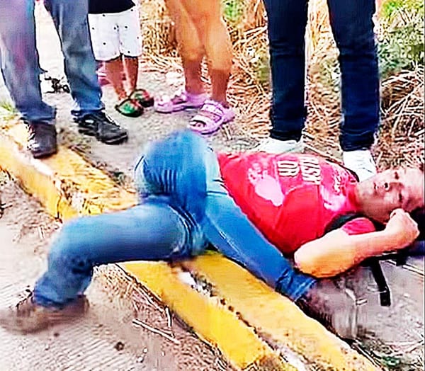 ¡MOTOCICLISTA SE IMPACTA CON POSTE Y SE FRACTURÓ A PIERNA!