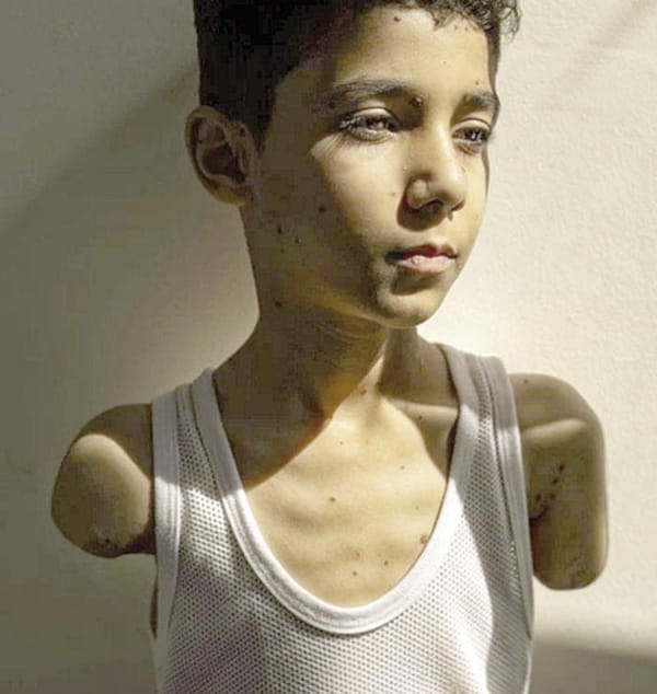 ¿CÓMO PODRÉ ABRAZARTE?"