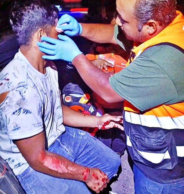 ¡“JINETE” MOTORIZADO DEJÓ “MEDIO CACHETE” EN EL PAVIMENTO!