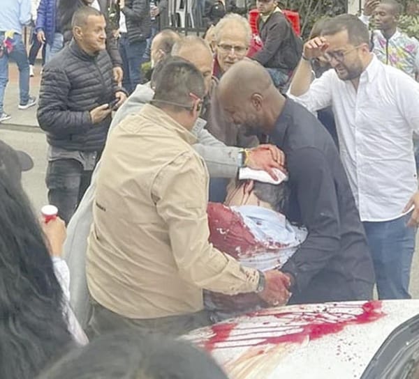 ¡MIGUEL URIBE ATRAVIESA “HORAS CRÍTICAS”! - TRAS ATENTADO