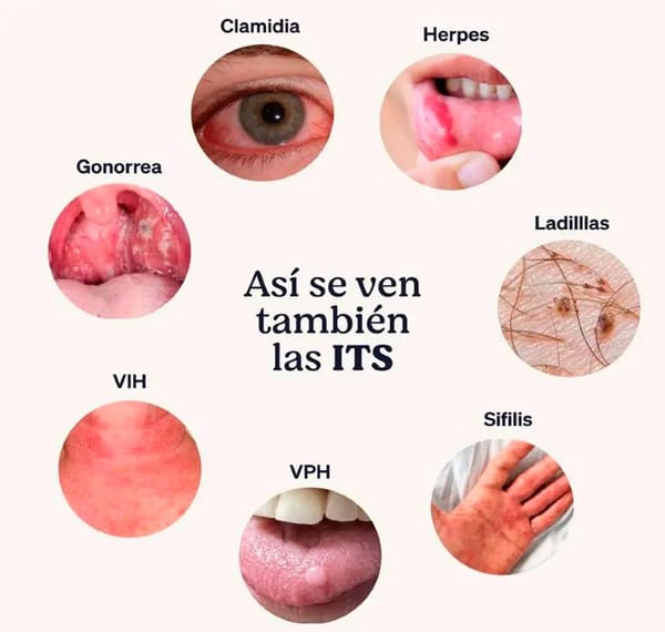 TIPS PARA MEJORAR TU CALIDAD DE VIDA | ENFERMEDADES DE TRANSMISIÓN SEXUAL - Las enfermedades de transmisión sexual son las que se transmiten a menudo, si no en todos los casos, de persona a persona a través del contacto sexual. Como la actividad sexual...