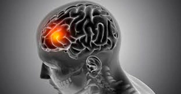 TIPS PARA MEJORAR TU CALIDAD DE VIDA | UN ICTUS - Un ictus, también conocido como accidente cerebrovascular (ACV) o ataque cerebral, ocurre cuando se interrumpe el flujo sanguíneo a una parte del cerebro, ya sea por un bloqueo...