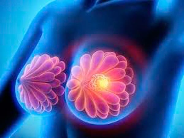 TIPS PARA MEJORAR TU CALIDAD DE VIDA | CÁNCER - El cáncer es una célula que ha perdido sus mecanismos de control normales y que adquiere por ello un crecimiento descontrolado. Puede desarrollarse a partir de cualquier tejido...