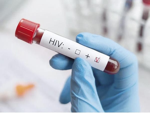 ¡APRUEBA UNIÓN EUROPEA FÁRMACO INYECTABLE PARA PREVENIR EL VIH!