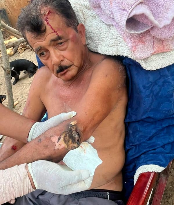 ¡SOBREVIVIÓ A DESCARGA ELÉCTRICA Y CAÍDA DE ÁRBOL!